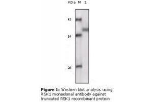 Image no. 2 for anti-Ribosomal Protein S6 Kinase, 90kDa, Polypeptide 1 (RPS6KA1) antibody (ABIN207641) (RPS6KA1 antibody)