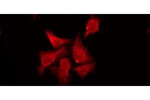 ABIN6274472 staining Hela by IF/ICC. (RASD2 antibody  (Internal Region))