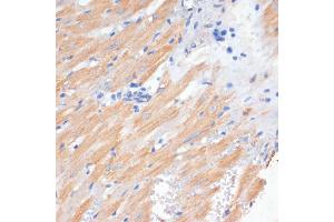 Immunohistochemistry of paraffin-embedded rat heart using PDCD2L antibody (ABIN6130653, ABIN6145336, ABIN6145337 and ABIN6223261) at dilution of 1:100 (40x lens).