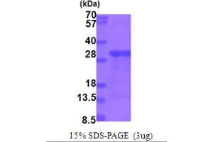SDS-PAGE (SDS) image for Fibroblast Growth Factor Binding Protein 1 (FGFBP1) (AA 24-234) protein (His tag) (ABIN5854027) (FGFBP1 Protein (AA 24-234) (His tag))