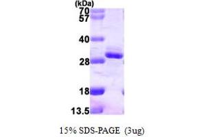 SDS-PAGE (SDS) image for Regulator of G-Protein Signaling 2 (RGS2) (AA 1-211) protein (His tag) (ABIN7279374) (RGS2 Protein (AA 1-211) (His tag))