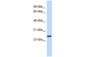 WB Suggested Anti-KLF16 Antibody Titration: 0.