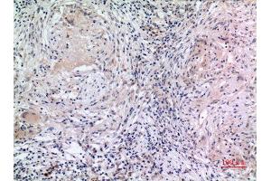 Immunohistochemistry (IHC) analysis of paraffin-embedded Human Lung, antibody was diluted at 1:100. (MCM7 antibody  (Internal Region))