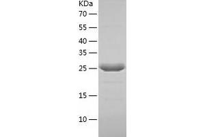 Western Blotting (WB) image for Abhydrolase Domain Containing 10 (ABHD10) (AA 53-306) protein (His tag) (ABIN7289067) (ABHD10 Protein (AA 53-306) (His tag))