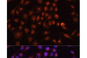 Immunofluorescence analysis of HeLa cells using RAB11A Polyclonal Antibody at dilution of 1:100. (RAB11A antibody)