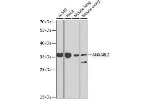 Western blot analysis of extracts of various cell lines, using L2 antibody (ABIN6129912, ABIN6136940, ABIN6136941 and ABIN6223557) at 1:1000 dilution. (ANXA8L2 antibody  (AA 1-276))