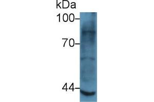 Western Blot; Sample: Rat Skeletal muscle lysate; Primary Ab: 5µg/ml Rabbit Anti-Human MMP3 Antibody Second Ab: 0. (MMP3 antibody  (AA 363-477))