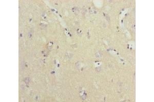 Immunohistochemistry of paraffin-embedded human brain tissue using ABIN7161439 at dilution of 1:100 (NPTN antibody  (AA 29-200))
