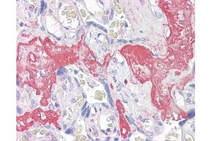 Anti-GAGED2 antibody IHC of human placenta. (XAGE1D antibody  (AA 58-69))