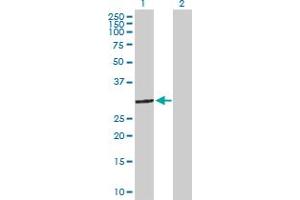 Western Blot analysis of STOM expression in transfected 293T cell line by STOM MaxPab polyclonal antibody. (Stomatin antibody  (AA 1-288))