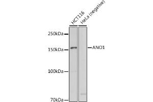 Western blot analysis of extracts of various cell lines, using  antibody (ABIN6129706, ABIN6136901, ABIN6136902 and ABIN6214776) at 1:1000 dilution.