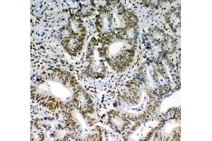 IHC analysis of PRDM1/Blimp1 using anti-PRDM1/Blimp1 antibody . (PRDM1 antibody  (AA 1-230))