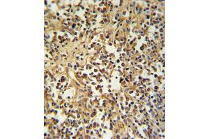 Immunohistochemistry (IHC) image for anti-Granzyme M (Lymphocyte Met-Ase 1) (GZMM) antibody (ABIN3002803)