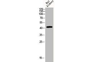 Western Blot analysis of Rat-kidney cells using Phospho-KOR-1 (S369) Polyclonal Antibody (OPRK1 antibody  (pSer369))