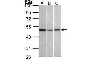 WB Image Sample (30 ug of whole cell lysate) A: A431 , B: Hela C: Hep G2 , 10% SDS PAGE antibody diluted at 1:1000 (KISS1R antibody  (C-Term))