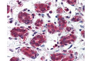 Anti-FOLH1 / PSMA antibody IHC of human breast. (PSMA antibody  (AA 117-351))