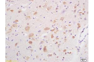 Formalin-fixed and paraffin embedded rat brain labeled with Anti GABRG2/GABA A Receptor gamma 2 Polyclonal Antibody, Unconjugated (ABIN754003) at 1:200 followed by conjugation to the secondary antibody and DAB staining (GABRG2 antibody  (AA 41-140))