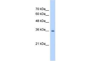 RSU1 antibody used at 1. (RSU1 antibody  (C-Term))