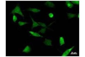 Immunostaining analysis in HeLa cells. (UBP1 antibody)