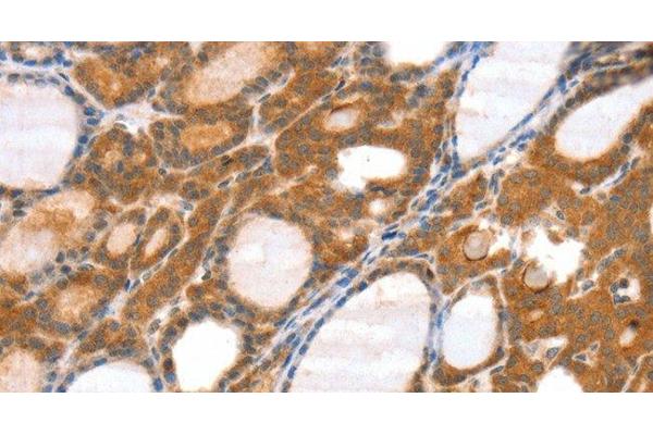 SRGAP3 antibody