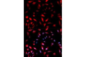 Immunofluorescence analysis of U2OS cell using Phospho-HSPB1-S82 antibody. (HSP27 antibody  (pSer82))