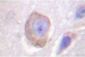 Image no. 1 for anti-Interleukin 3 Receptor, alpha (IL3RA) antibody (ABIN265478) (IL3RA antibody)