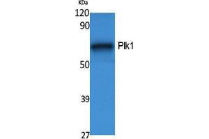 Western Blotting (WB) image for anti-Polo-Like Kinase 1 (PLK1) (Thr256) antibody (ABIN3178086) (PLK1 antibody  (Thr256))