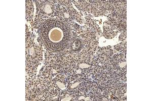 IHC analysis of U1A/SNRPA using anti-U1A/SNRPA antibody (ABIN7600891). (SNRPA1 antibody  (AA 25-218))