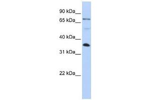 LASP1 antibody used at 1 ug/ml to detect target protein. (LASP1 antibody  (C-Term))