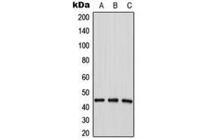 Western blot analysis of LPAAT delta expression in HepG2 (A), MDAMB435 (B), MCF7 (C) whole cell lysates.