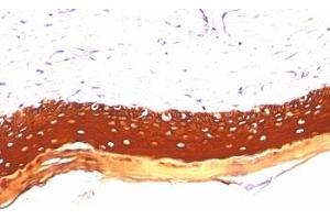 Formalin paraffin human skin stained with Acidic Cytokeratin antibody (KRTL/1077). (Keratin Acidic (AE1) antibody)