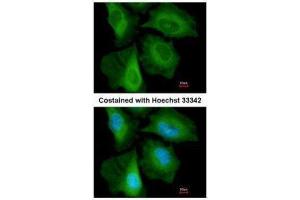 ICC/IF Image Immunofluorescence analysis of paraformaldehyde-fixed HeLa, using CacyBP, antibody at 1:200 dilution. (CACYBP antibody  (C-Term))