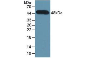 Western blot analysis of recombinant Human CFH. (Complement Factor H antibody  (AA 860-1231))