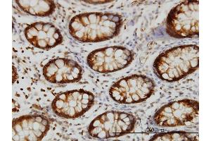 Immunoperoxidase of monoclonal antibody to HSPA2 on formalin-fixed paraffin-embedded human colon. (HSPA2 antibody  (AA 1-639))