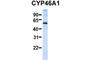 Western Blotting (WB) image for anti-Cytochrome P450, Family 46, Subfamily A, Polypeptide 1 (CYP46A1) (C-Term) antibody (ABIN2773829)