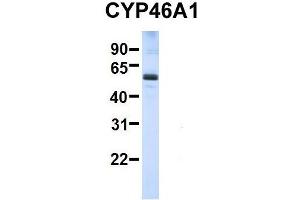 Host:  Rabbit  Target Name:  SERPINA3  Sample Type:  Human Adult Placenta  Antibody Dilution:  1. (CYP46A1 antibody  (C-Term))