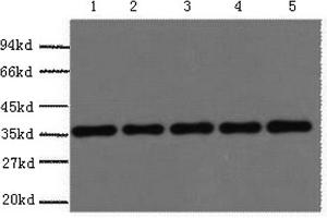 Western Blotting (WB) image for anti-Glyceraldehyde-3-Phosphate Dehydrogenase (GAPDH) antibody (ABIN5959504) (GAPDH antibody)