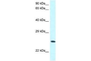 Western Blot showing WWOX antibody used at a concentration of 1 ug/ml against COLO205 Cell Lysate (WWOX antibody  (C-Term))