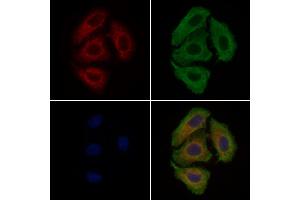 ABIN6260505 and ABIN6279264 staining Hela cells by IF/ICC. (CATSPER3 antibody  (Internal Region))