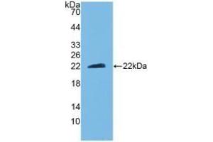 Detection of Recombinant CNTF, Mouse using Polyclonal Antibody to Ciliary Neurotrophic Factor (CNTF) (CNTF antibody  (AA 2-198))