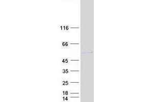 Western Blotting (WB) image for ARP3 Actin-Related Protein 3 Homolog B (ACTR3B) (Transcript Variant 1) protein (Myc-DYKDDDDK Tag) (ABIN2716389)