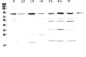Western blot analysis of BAP1 using anti-BAP1 antibody .
