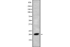 Western blot analysis of RNF5 using Jurkat whole cell lysates (RNF5 antibody  (C-Term))