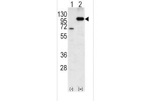 Western blot analysis of P (arrow) using rabbit polyclonal P Antibody (C-term) 6306b. (APP antibody  (C-Term))