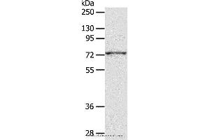 Western blot analysis of PC3 cell, using ADAM10 Polyclonal Antibody at dilution of 1:300 (ADAM10 antibody)
