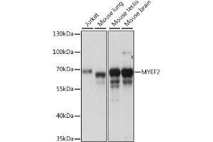 Western blot analysis of extracts of various cell lines, using MYEF2 antibody (ABIN7268721) at 1:1000 dilution. (MYEF2 antibody  (AA 1-120))