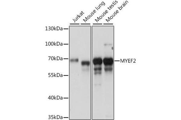 MYEF2 antibody  (AA 1-120)