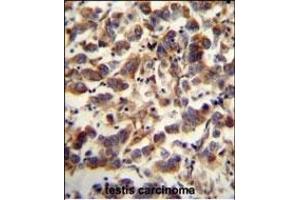 Immunohistochemistry (Paraffin-embedded Sections) (IHC (p)) image for anti-Transcription Factor A, Mitochondrial (TFAM) (AA 216-246), (C-Term) antibody (ABIN654229)