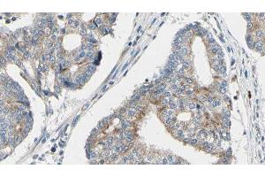 ABIN6276606 at 1/100 staining Human prostate tissue by IHC-P. (TPM3 antibody  (N-Term))