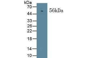 Detection of Recombinant MAPKAP1, Human using Polyclonal Antibody to Mitogen Activated Protein Kinase Associated Protein 1 (MAPKAP1)